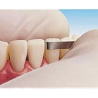 Finishing Strips | Compo-Strip Orthodontic Strips - 200T2 | Premier (3/pk)